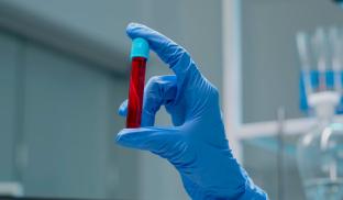 Terapias-alvo e CAR-T Cell